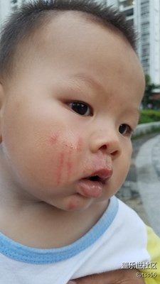 可憐的娃，爺爺沒看住摔了