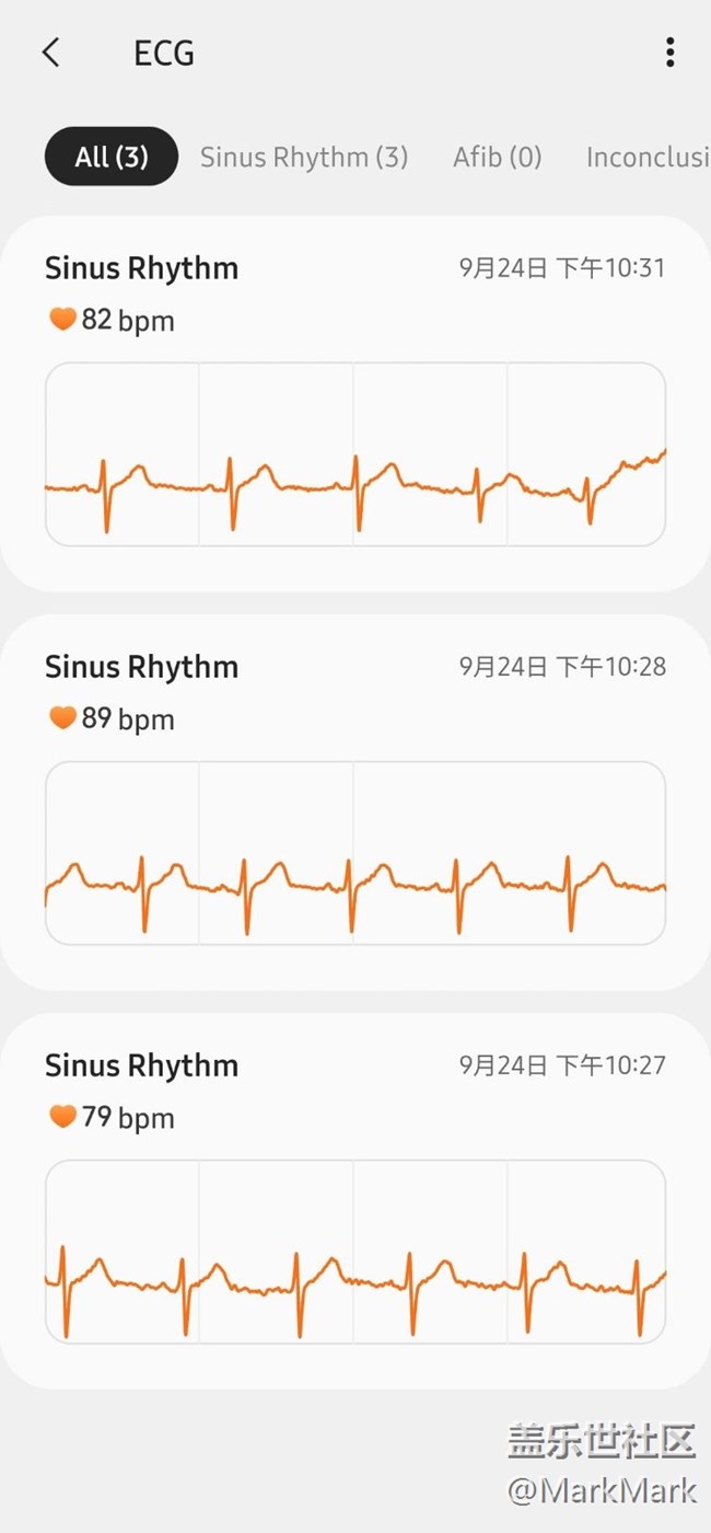 終于ECG