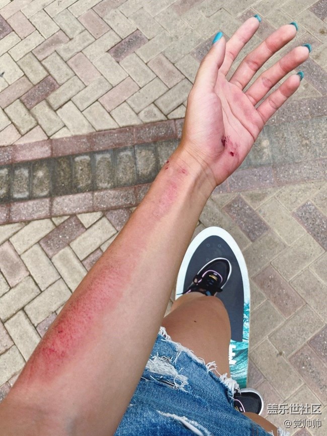 陸地沖浪板初體驗—滑雪人的夏季輔助練習 陸地沖浪板初體驗—滑雪人的夏季輔助練習