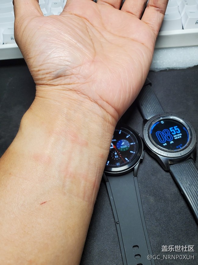 Galaxy Watch4表帶有疑似過(guò)敏現(xiàn)象