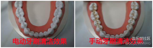 電動牙刷怎么選？四類傷牙坑貨危害深遠！