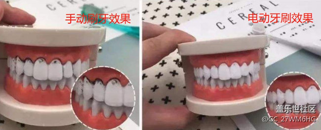 電動(dòng)牙刷好不好用？盤點(diǎn)三大危害隱患，再不踩雷！