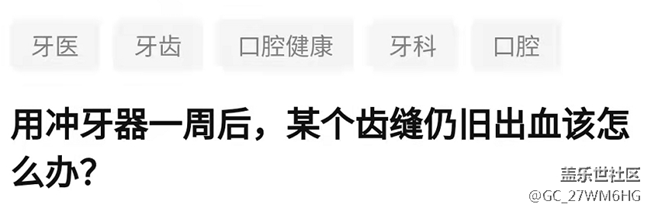 沖牙器怎么選？務(wù)必留心這三大傷牙雷區(qū)！