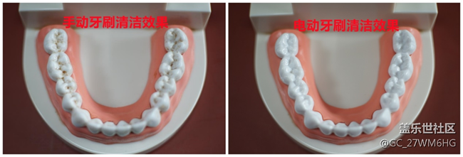 電動牙刷刷得更干凈嗎？剖析四大傷牙原因！
