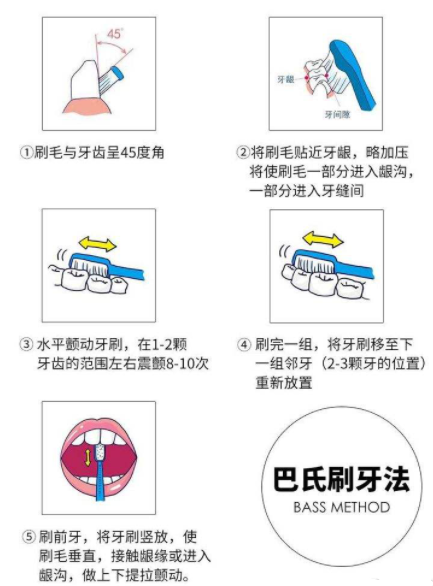 電動(dòng)牙刷真的對(duì)牙齒好嗎？博主科普四大禁忌點(diǎn)！