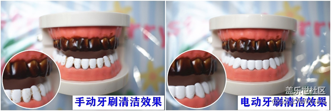 電動(dòng)牙刷真的對(duì)牙齒好嗎？博主科普四大禁忌點(diǎn)！