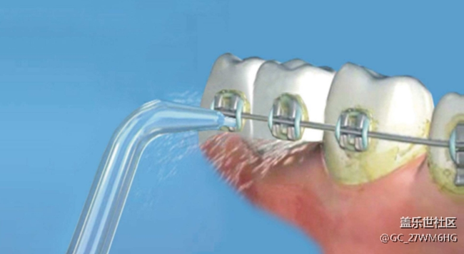 沖牙器有效果嗎？揭秘三大傷牙原因！