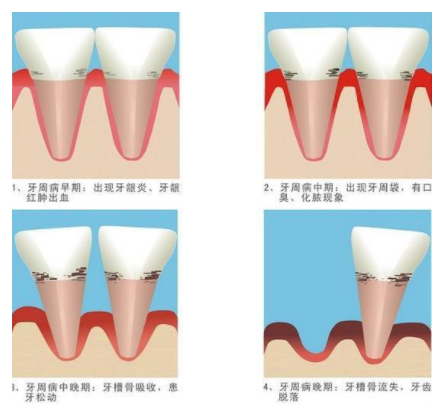 電動(dòng)牙刷的危害科普：四類(lèi)坑貨千萬(wàn)不要碰！