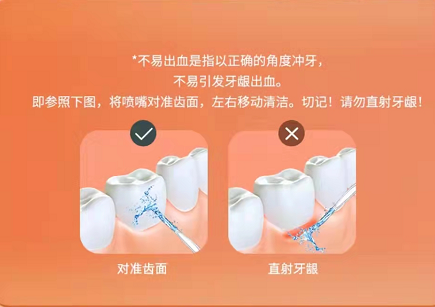 沖牙器的危害弊端有哪些？這三類人群千萬當(dāng)心