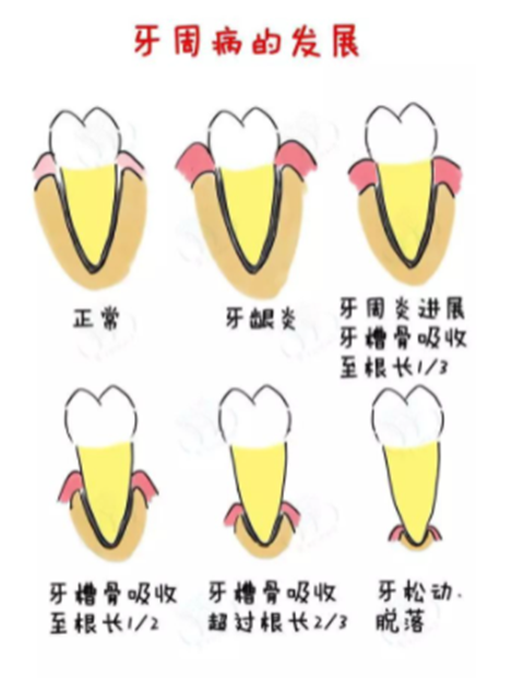 哪些人不適合電動牙刷？五類特殊人群慎用!