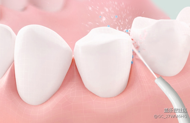 沖牙器的危害弊端有哪些？這三類人群千萬當(dāng)心