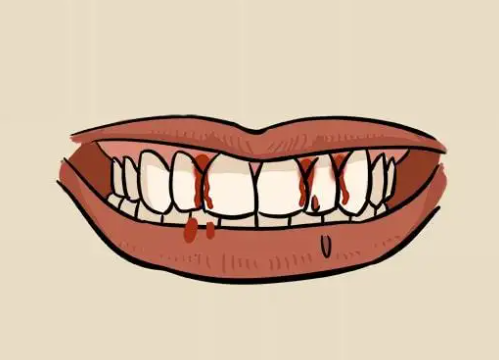 如何正確選購沖牙器？四大傷牙誤區(qū)要警惕！