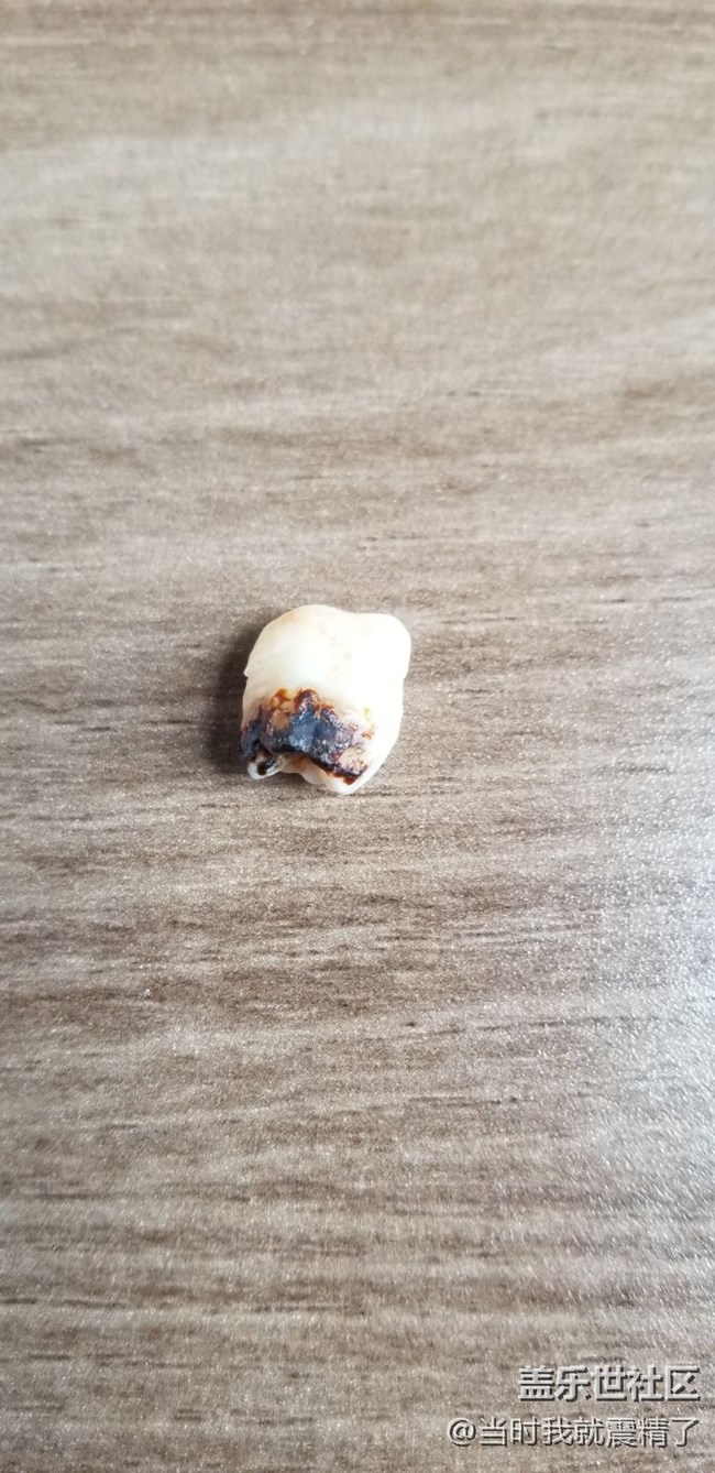 拔了一顆智齒，大圖伺候~