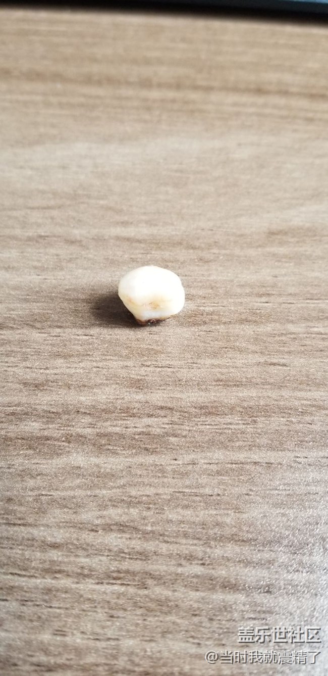 拔了一顆智齒，大圖伺候~