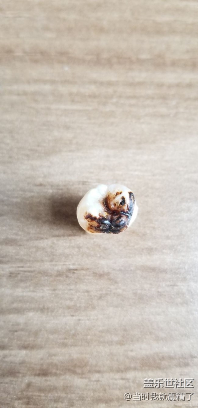 拔了一顆智齒，大圖伺候~