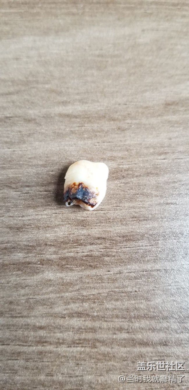 趕快去拔智齒，不然你也會像我這樣~
