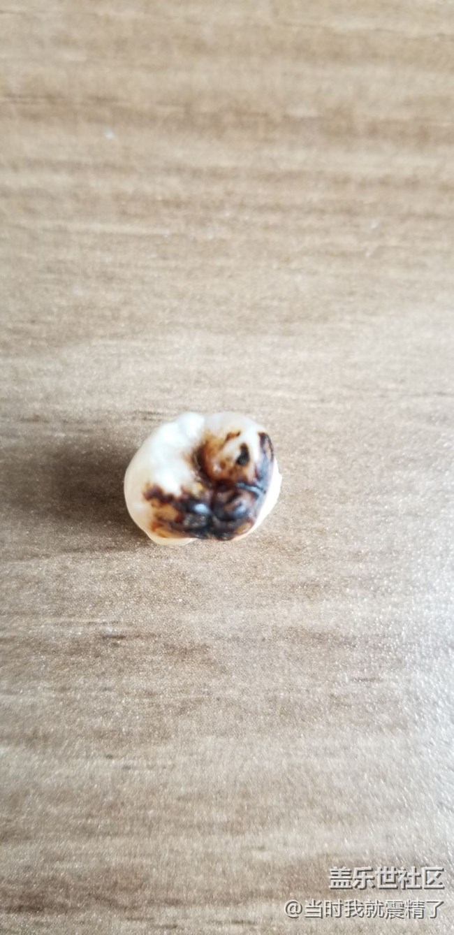 趕快去拔智齒，不然你也會像我這樣~